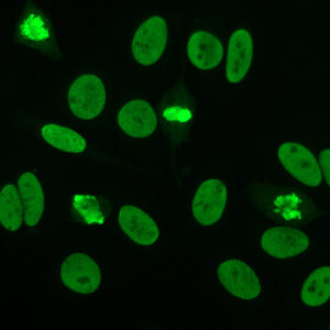Anti Nuclear Antibody Naokon
