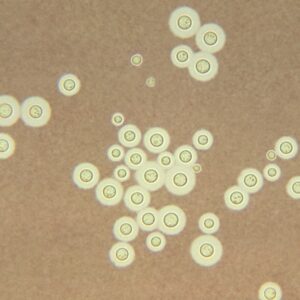 Cryptococcus Antigen Test Naokon