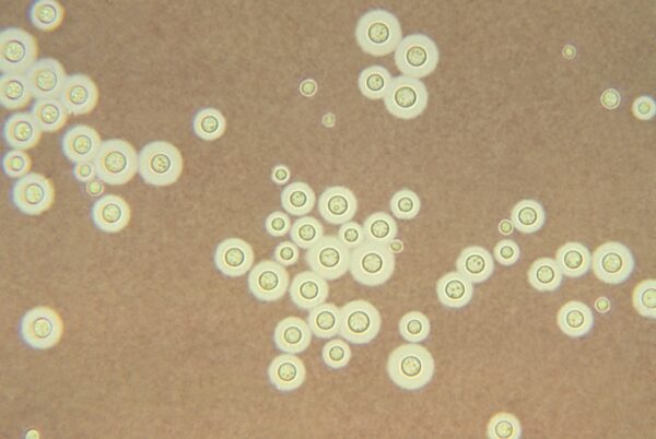 Cryptococcus Antigen Test Naokon