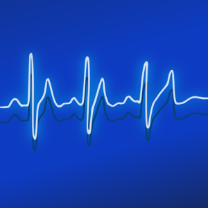 ECG Naokon