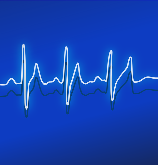 ECG Naokon