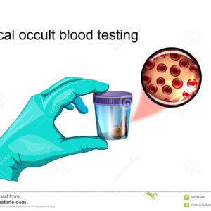 Fecal Occult Blood Naokon
