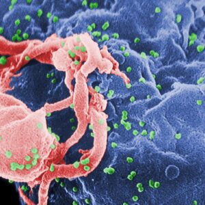 HIV Antibody Naokon