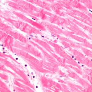 Histopathology Naokon