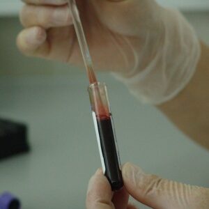 Naokon Immunology