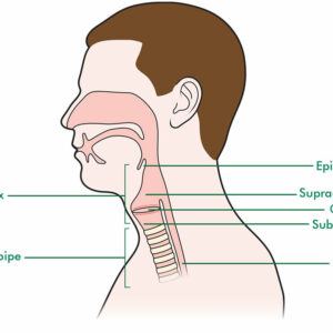 Laryngeal Wash Naokon