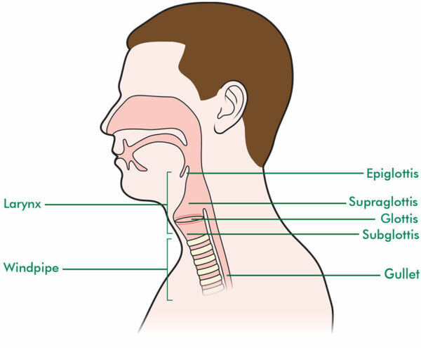 Laryngeal Wash Analysis | NAOKON DIAGNOSTICS