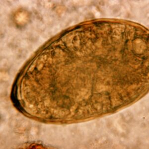 Paragonimus Eggs Naokon
