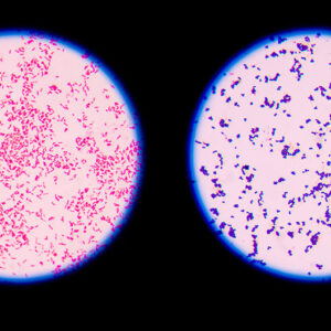 Gram Stain Naokon