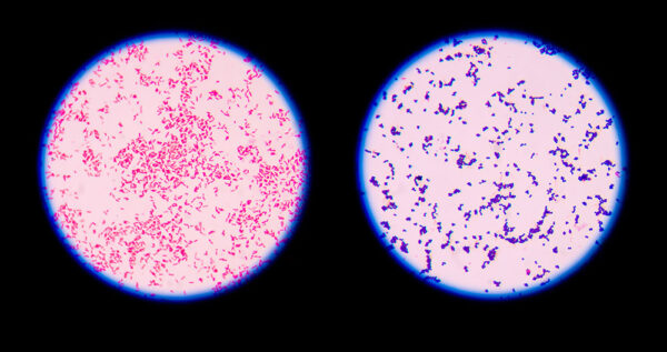 Gram Stain Naokon