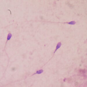 Semen Analysis Naokon