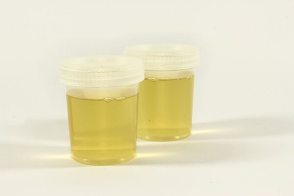 Naokon Urine Test